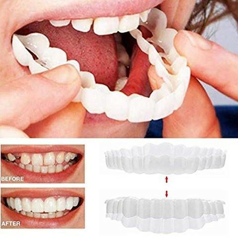 irvingwad 50% OFF --Perfect Smile Snap-On Braces